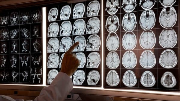 An Introduction to Neuroscience: A Comprehensive Guide for Novice Researchers