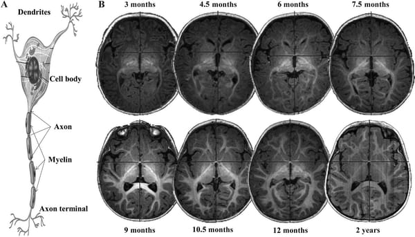The Early Years of Brain Development: A Window into Cognitive